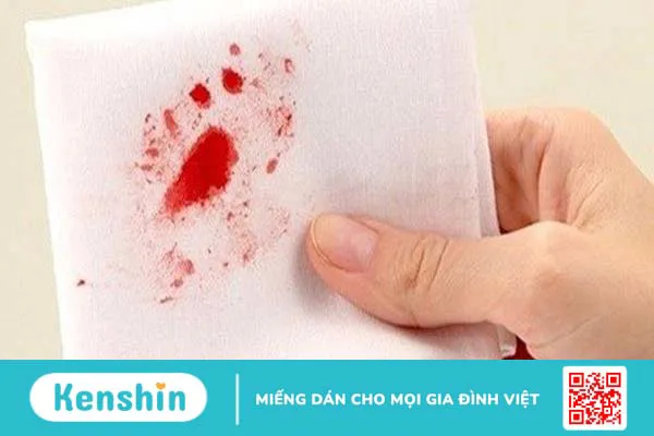 Dấu hiệu bệnh bạch cầu trong giai đoạn đầu tiên của bệnh