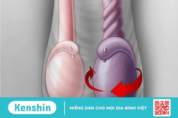 Dấu hiệu chấn thương tinh hoàn và cách xử lý