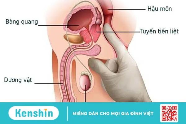 Dấu hiệu tuyến tiền liệt có vấn đề là gì?