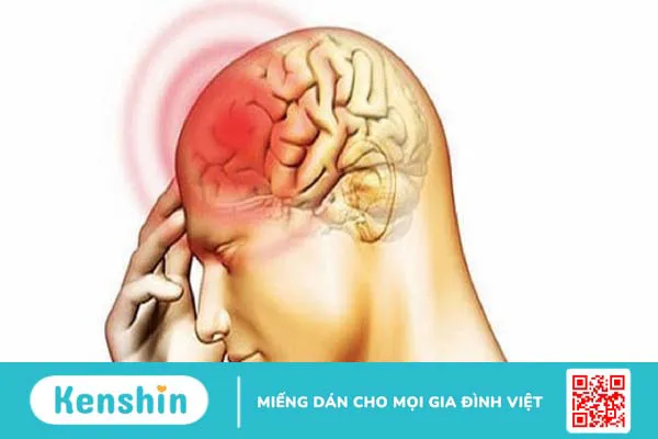 Dấu hiệu ung thư não giai đoạn đầu mà bạn cần cảnh giác