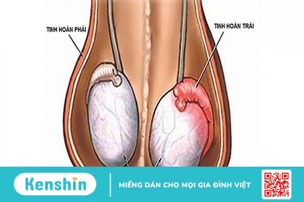 Dấu hiệu và cách điều trị rối loạn nội tiết tố 3