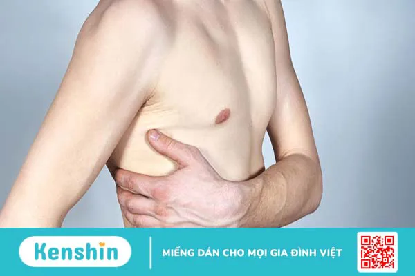 Đau sườn phải dưới nách có nguy hiểm không?