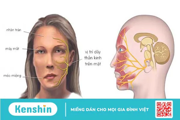 Dây thần kinh số 7 nằm ở đâu? Nguyên nhân tổn thương dây thần kinh số 7