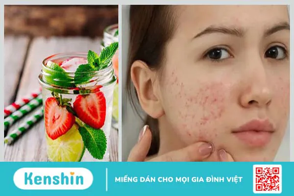 Detox thải độc trị mụn: Lợi ích, cách thực hiện và một số lưu ý