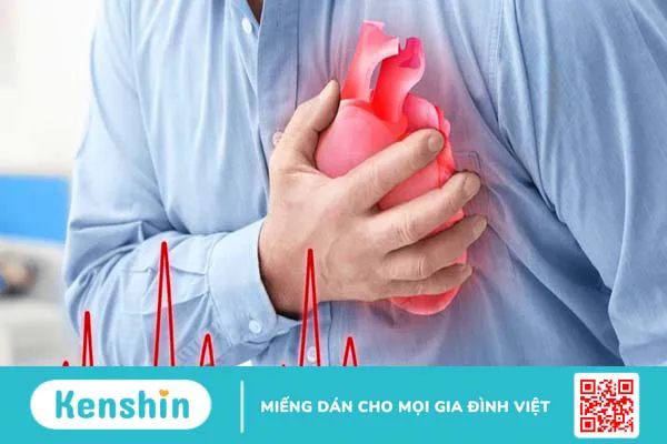 Dị dạng mạch vành là gì? Nguyên nhân, triệu chứng và phương pháp điều trị