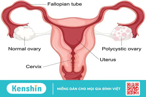 Đi khám kinh nguyệt không đều ở đâu uy tín?