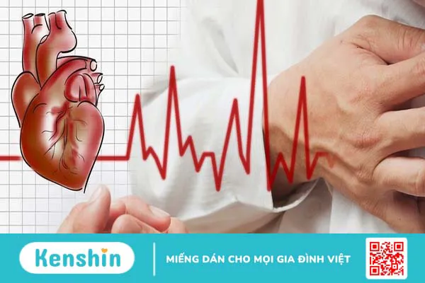 Điện sinh lý tim: Tổng quan, giá trị, chỉ định và quy trình thực hiện thăm dò