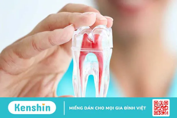 Điều trị nội nha là gì? Tại sao cần phải điều trị nội nha?