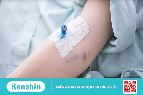 Dinh dưỡng tĩnh mạch hoàn toàn là như thế nào?