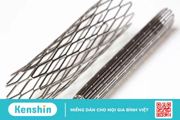 Độ bền của stent mạch vành và những điều cần biết