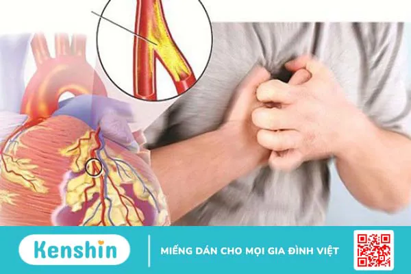 Đo độ cứng động mạch là gì? Giá trị và phương pháp đo độ cứng động mạch