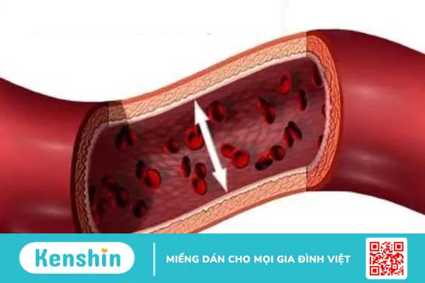 Đo độ cứng động mạch là gì? Giá trị và phương pháp đo độ cứng động mạch