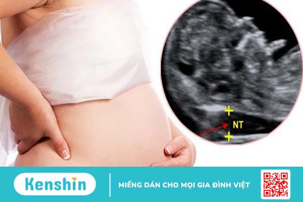 Độ mờ da gáy 0.9 mm có bình thường không?