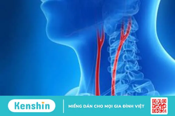 Động mạch cổ nằm ở vị trí nào? Chức năng và vai trò trong lâm sàng