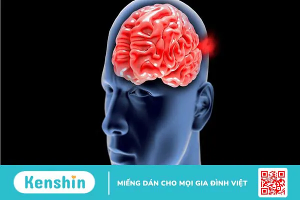 Tìm hiểu về đông máu nội mạch lan tỏa 2