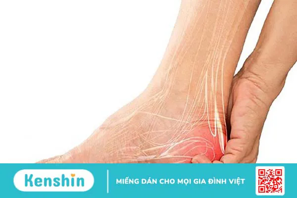 Đứt gân gót chân: Nguyên nhân, dấu hiệu và cách điều trị