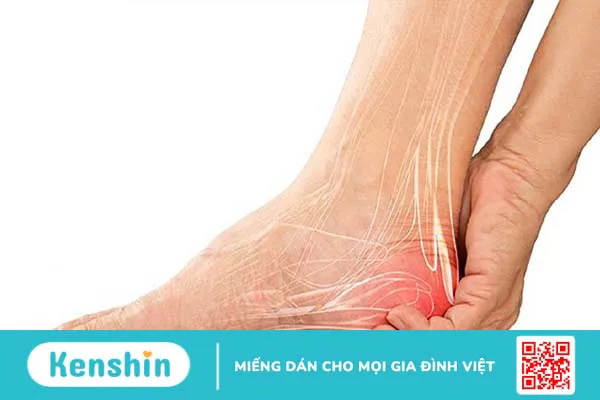 Đứt gân gót chân: Nguyên nhân, dấu hiệu và cách điều trị