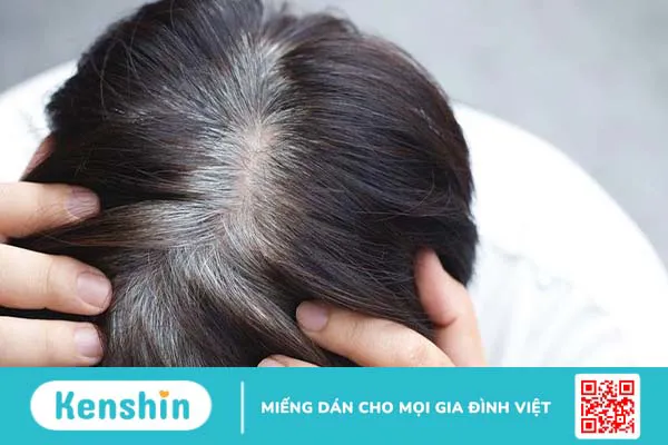 Eumelanin và Pheomelanin: Yếu tố quan trọng tạo nên màu sắc của tóc