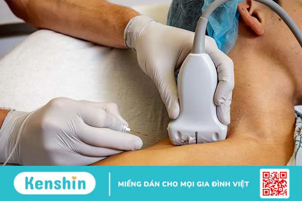 Gây tê vùng phong bế thần kinh ngoại vi những thông tin cần biết 2