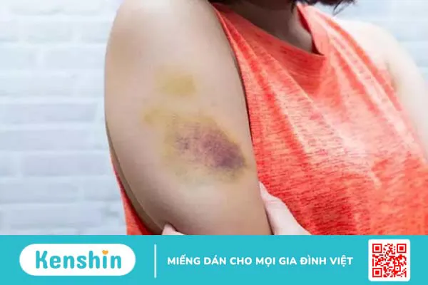 Gây tê vùng phong bế thần kinh ngoại vi những thông tin cần biết 4