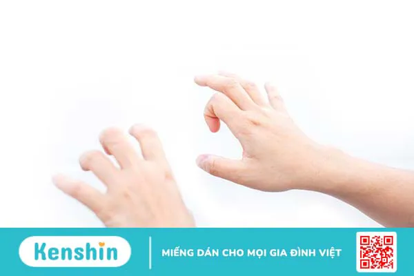 Giải đáp: Chi phí phẫu thuật chỉnh hình ngón tay bao nhiêu?