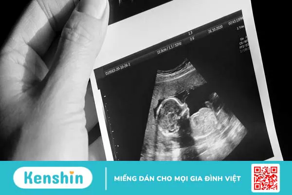 Giải đáp sức khỏe sinh sản: Không đo độ mờ da gáy có sao không?