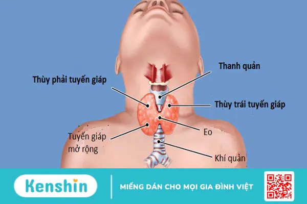 Giải đáp thắc mắc: Cường giáp có gây ung thư không?