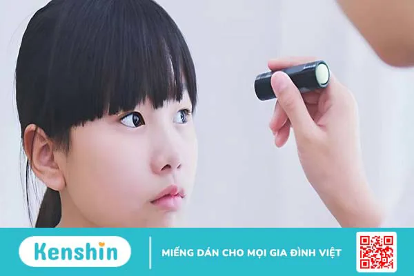 Giải đáp thắc mắc: Lác mắt bẩm sinh có chữa được không?