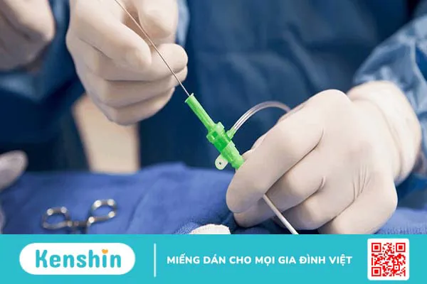 Giải đáp thắc mắc: Sinh thiết tuyến tiền liệt bao lâu có kết quả?