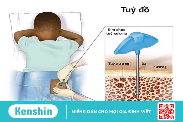 Giải đáp thắc mắc y khoa: Xét nghiệm sinh thiết có những loại nào?