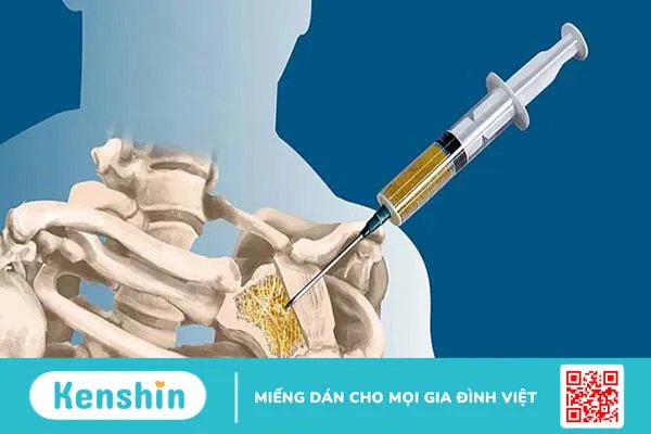 Giải đáp y khoa: Kết quả sinh thiết có chính xác không?