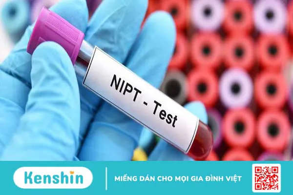 Giải đáp y khoa: Xét nghiệm NIPT rồi có cần làm thêm Double Test không? 2