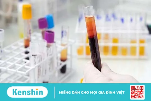 Giải đáp y khoa: Xét nghiệm NIPT rồi có cần làm thêm Double Test không? 3