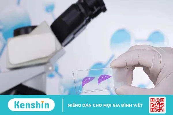 Giải đáp y khoa: Xét nghiệm sinh thiết bao lâu có kết quả?