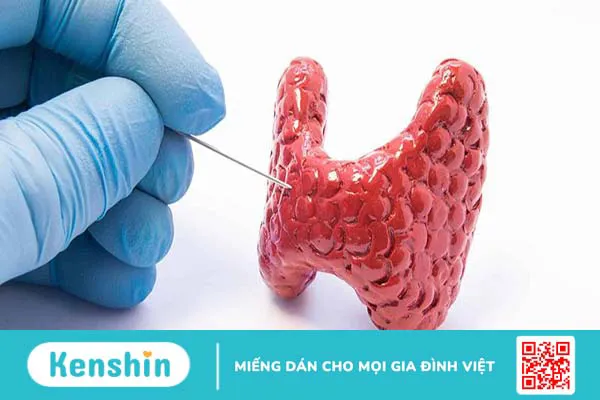 Giải đáp y khoa: Xét nghiệm sinh thiết bao lâu có kết quả?