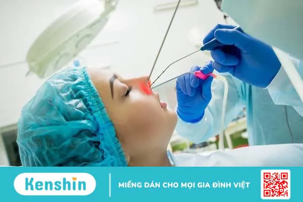 giai-phap-cat-polyp-mui-bang-laser-cho-benh-nhan-viem-xoang-mui 2.webp