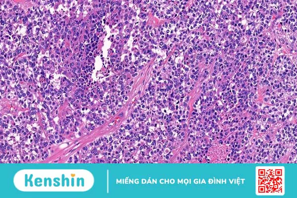 Giải phẫu bệnh là gì? Các xét nghiệm giải phẫu bệnh thường gặp