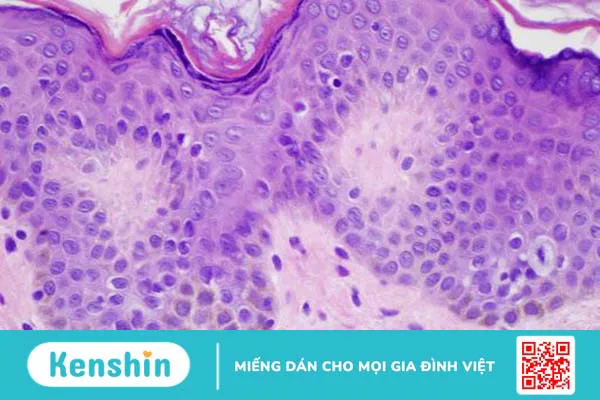 Giải phẫu bệnh là gì? 1