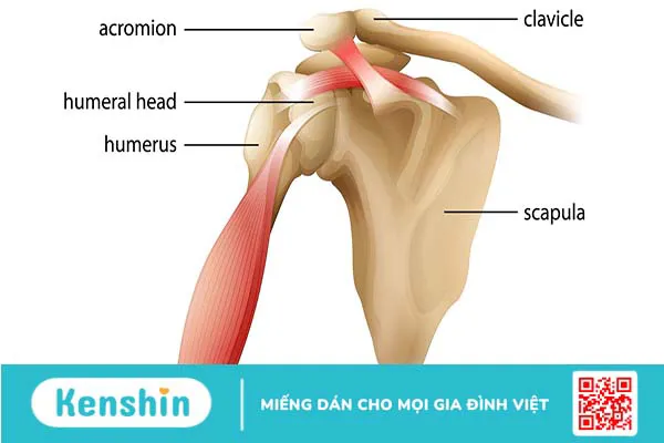 Giải phẫu khớp vai và các bệnh lý thường gặp ở khớp vai