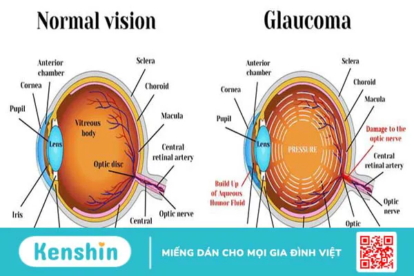 Giải phẫu mắt và các bệnh lý về mắt 6