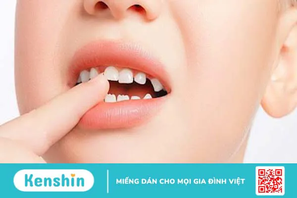 Giải phẫu răng: Cấu tạo và chức năng của từng loại răng