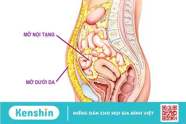 Giảm mỡ nội tạng bằng cách nào?