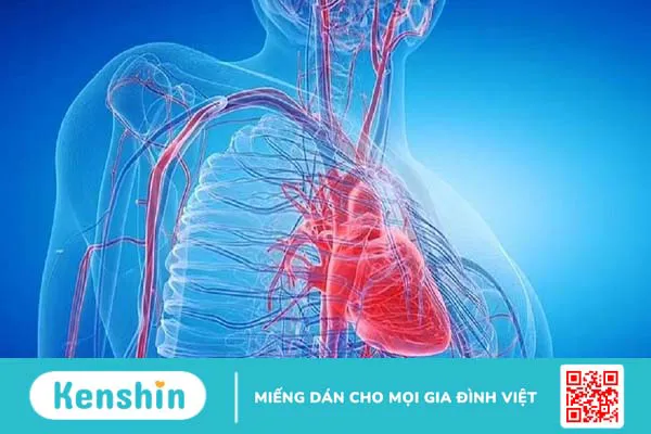 Giãn động mạch vành là gì? Triệu chứng, cách điều trị và phòng ngừa bệnh