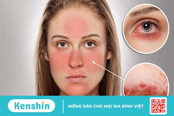 Glycerin trong mỹ phẩm có tác dụng gì đối với làn da, bạn có biết?