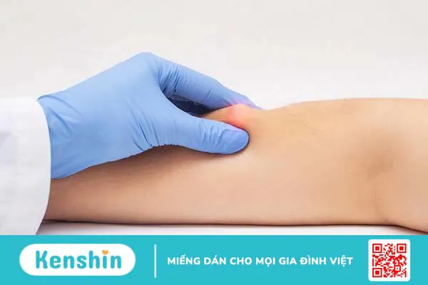 Góc giải đáp thắc mắc: Khám u mỡ ở bệnh viện nào tại Hà Nội?