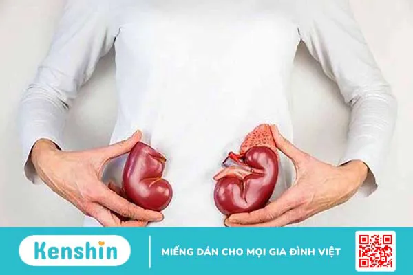 Góc giải đáp: Viêm cầu thận mạn sống được bao lâu?