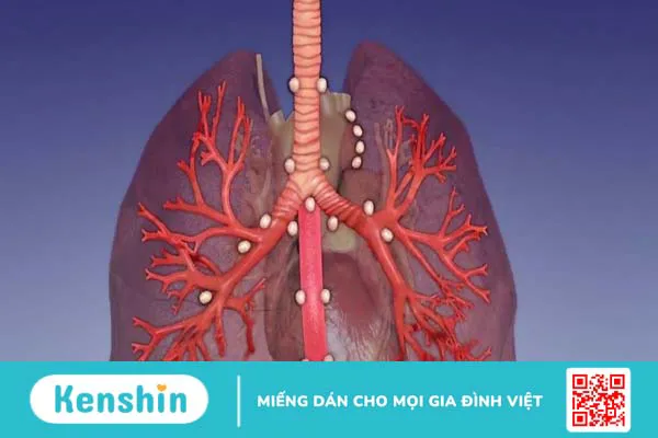 Hạch ở phổi có nguy hiểm không? Nguyên nhân và phương pháp điều trị