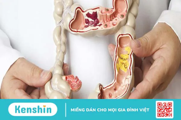 Hậu môn bình thường có cấu tạo và chức năng như thế nào?