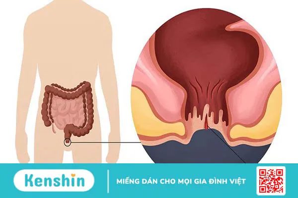 Hậu môn bình thường có cấu tạo và chức năng như thế nào?