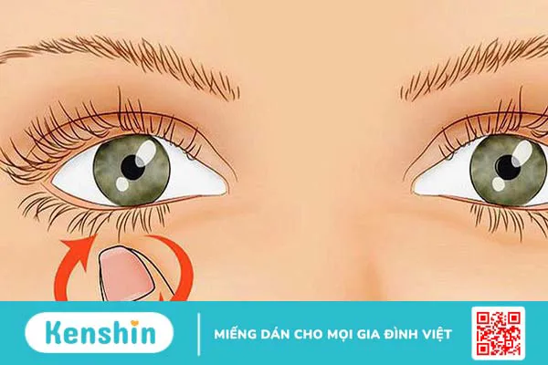 Hiện tượng co giật mắt là như thế nào? Làm sao hết co giật mắt hiệu quả?